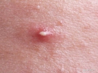 補腎壯陽吃什么藥效果好